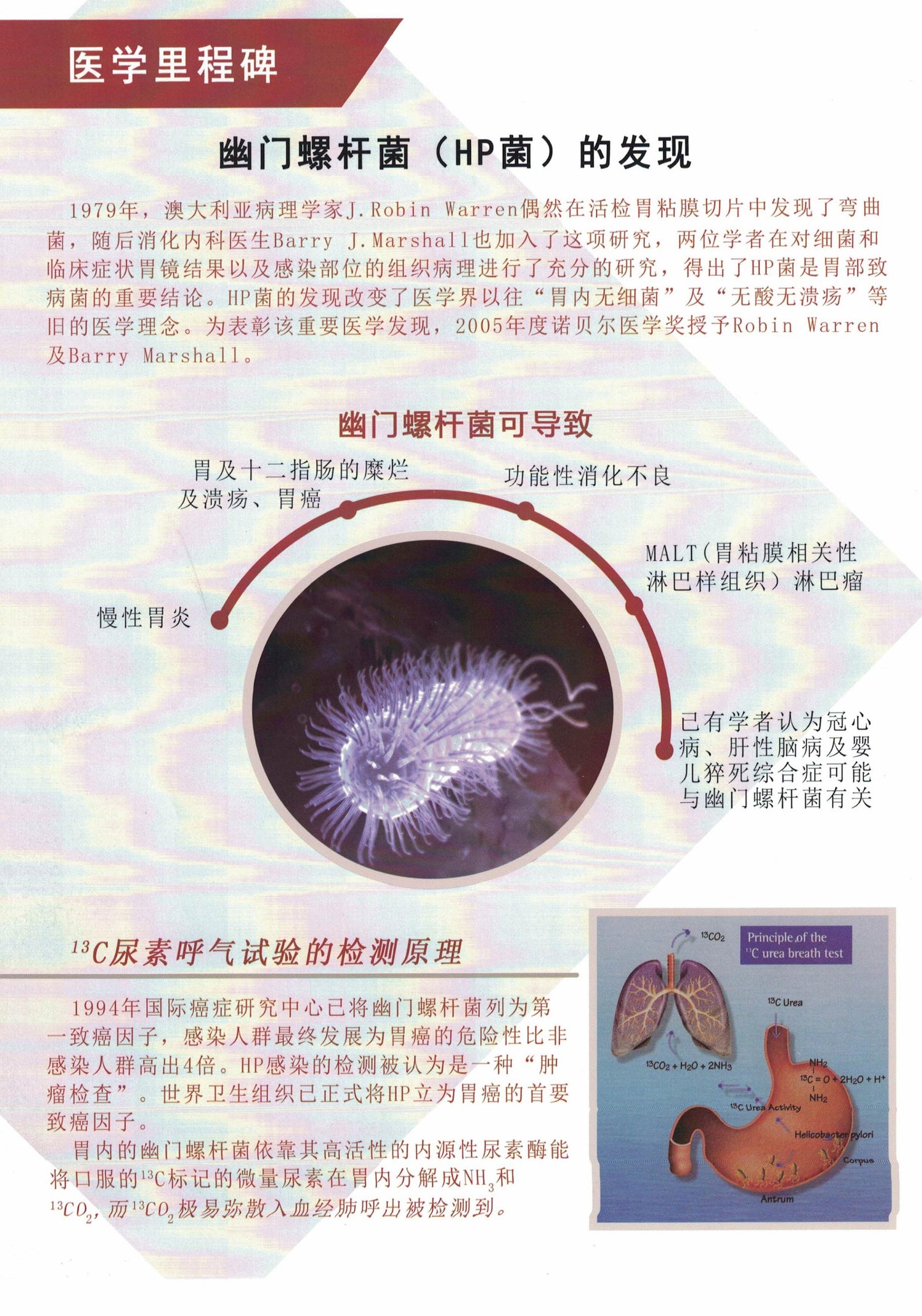 13c Urea Breath Test Kit for Diagnosis of Helicobacter Pylori Detection device