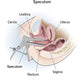 Vaginal Speculum Grave Type and Cusco type