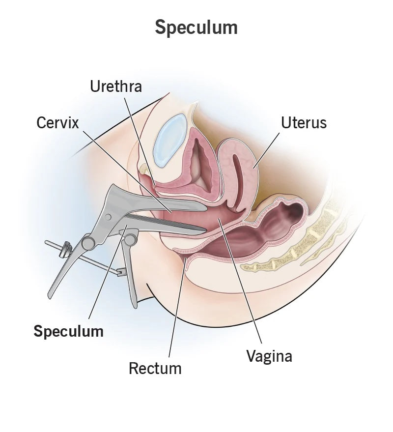 Vaginal Speculum Grave Type and Cusco type